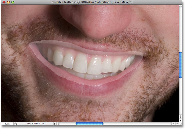 After brightening his teeth, the rest of the selected area has also been brightened.   Image © 2008 Photoshop Essentials.com.