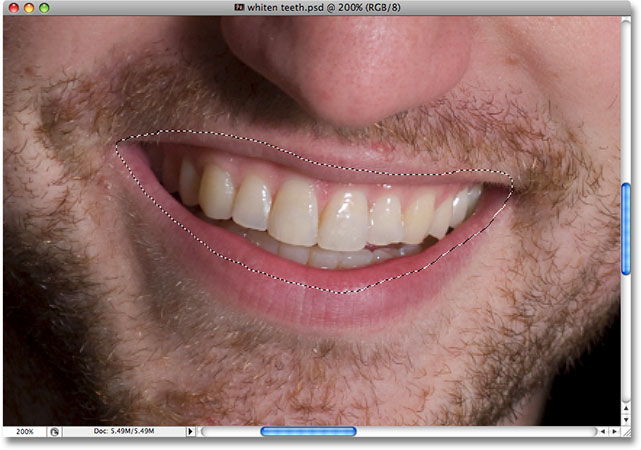 Using the Lasso Tool in Photoshop to select an area around the man's teeth. Image © 2008 Photoshop Essentials.com.