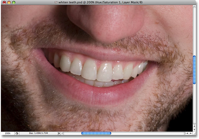 The teeth are now whiter after removing the yellow. Image © 2008 Photoshop Essentials.com.