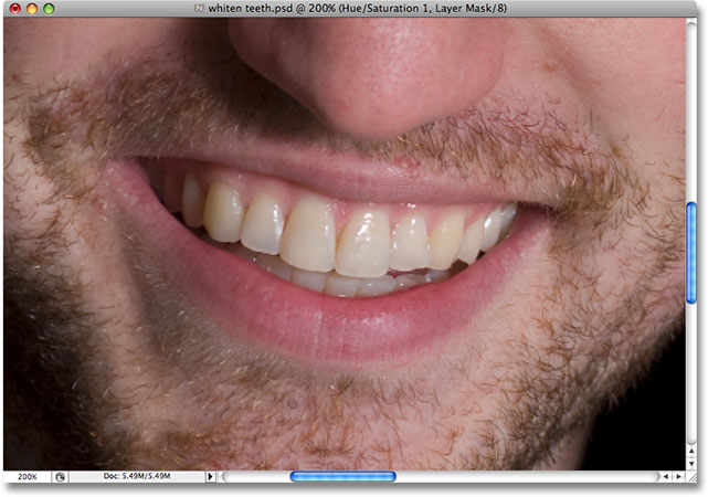 Yellow teeth in Photoshop. Image © 2008 Photoshop Essentials.com.