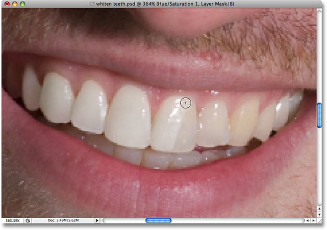 Revealing the whitening of the teeth. Image © 2008 Photoshop Essentials.com.